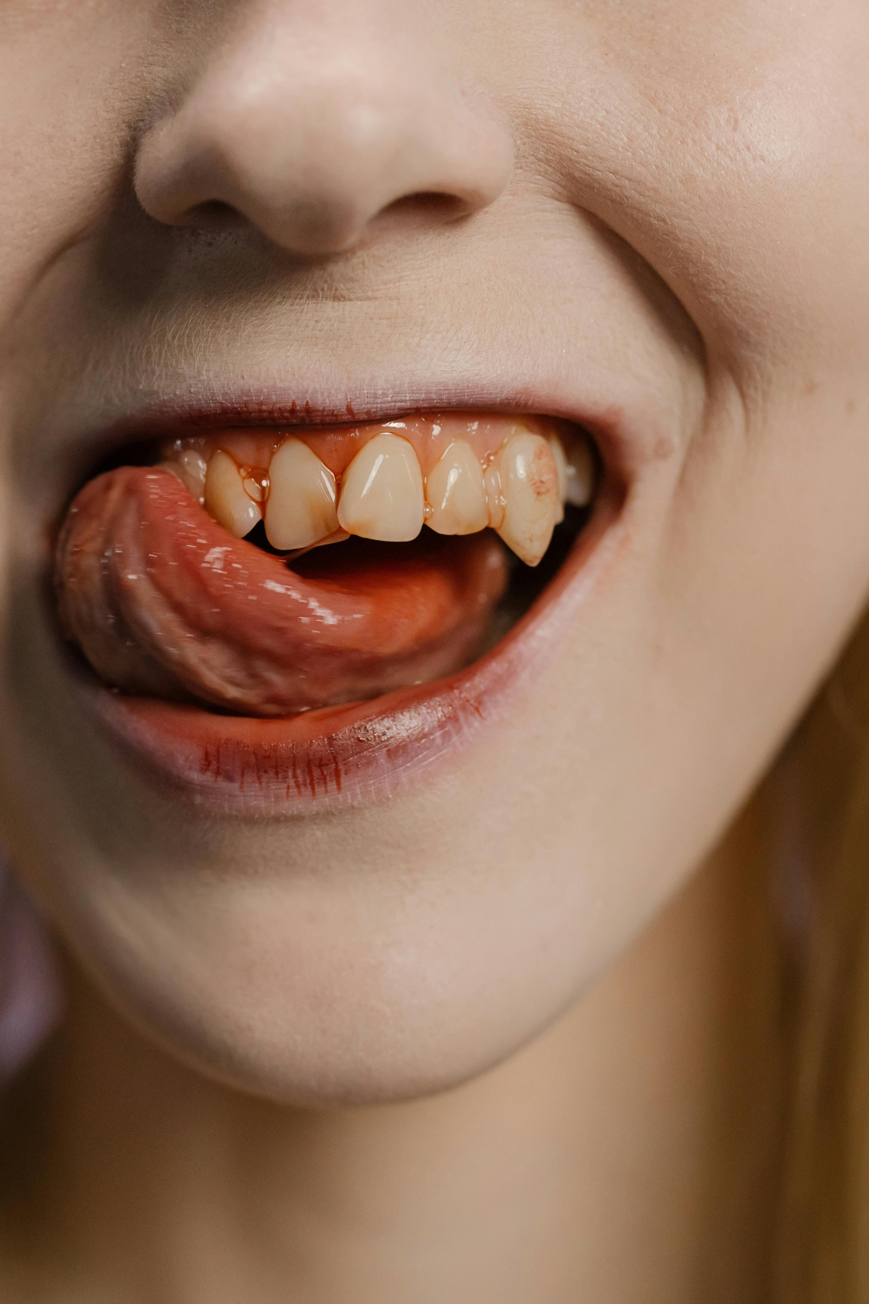 Vampire teeth